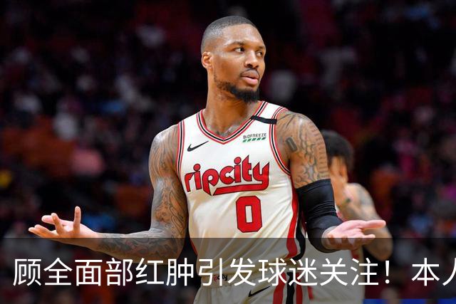 顾全面部红肿引发球迷关注！本人解释是多年皮肤问题并非外伤伤疤